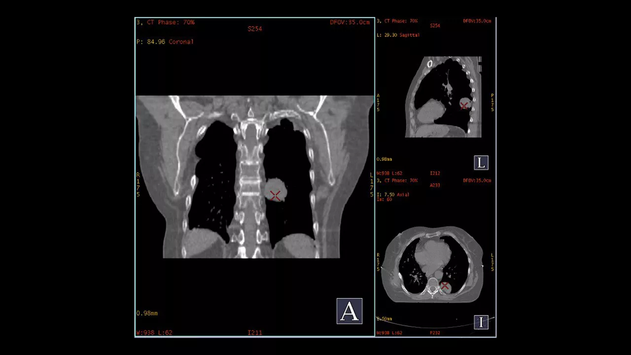 GEHEALTHCARE_CT_SmartSubscription_Advantage4D_1920x1080