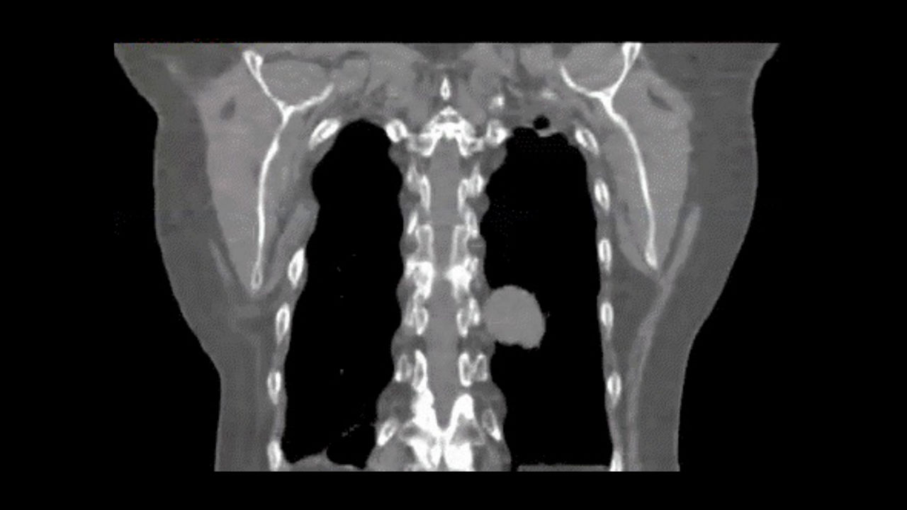 GEHEALTHCARE_CT_SmartSubscription_Deviceless4D_1920x1080