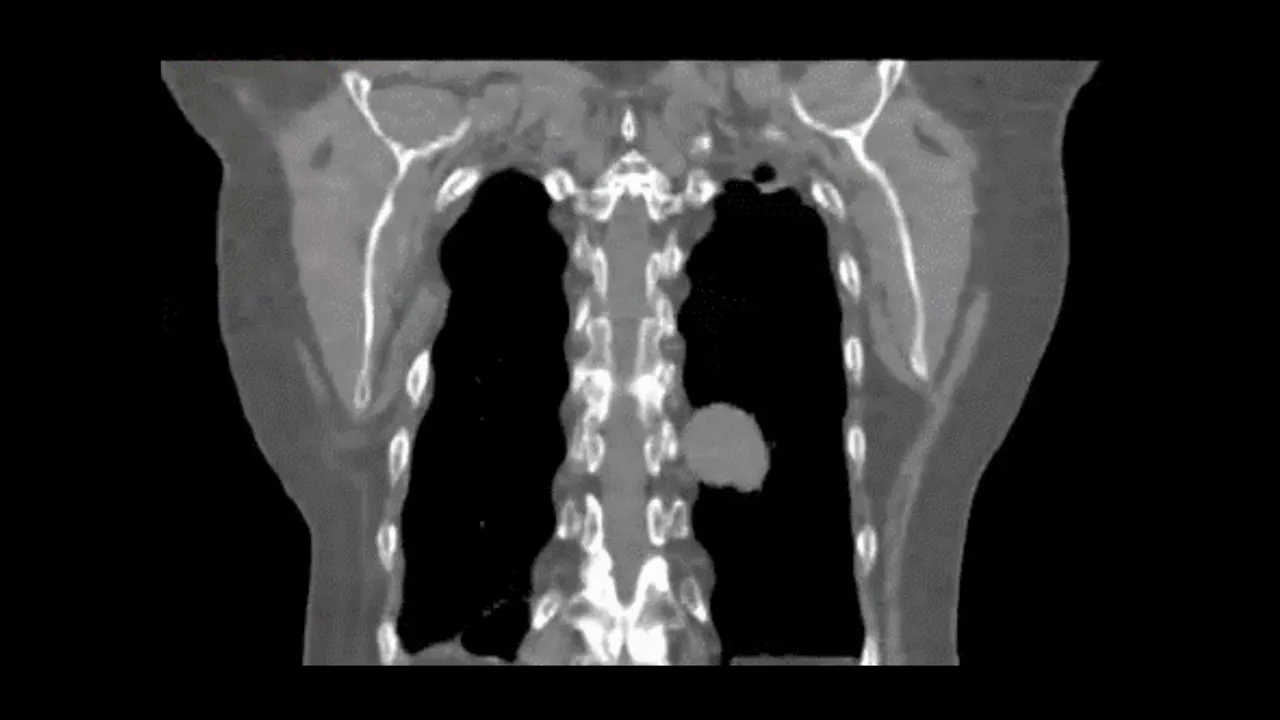 GEHEALTHCARE_CT_SmartSubscription_Deviceless4D_1920x1080