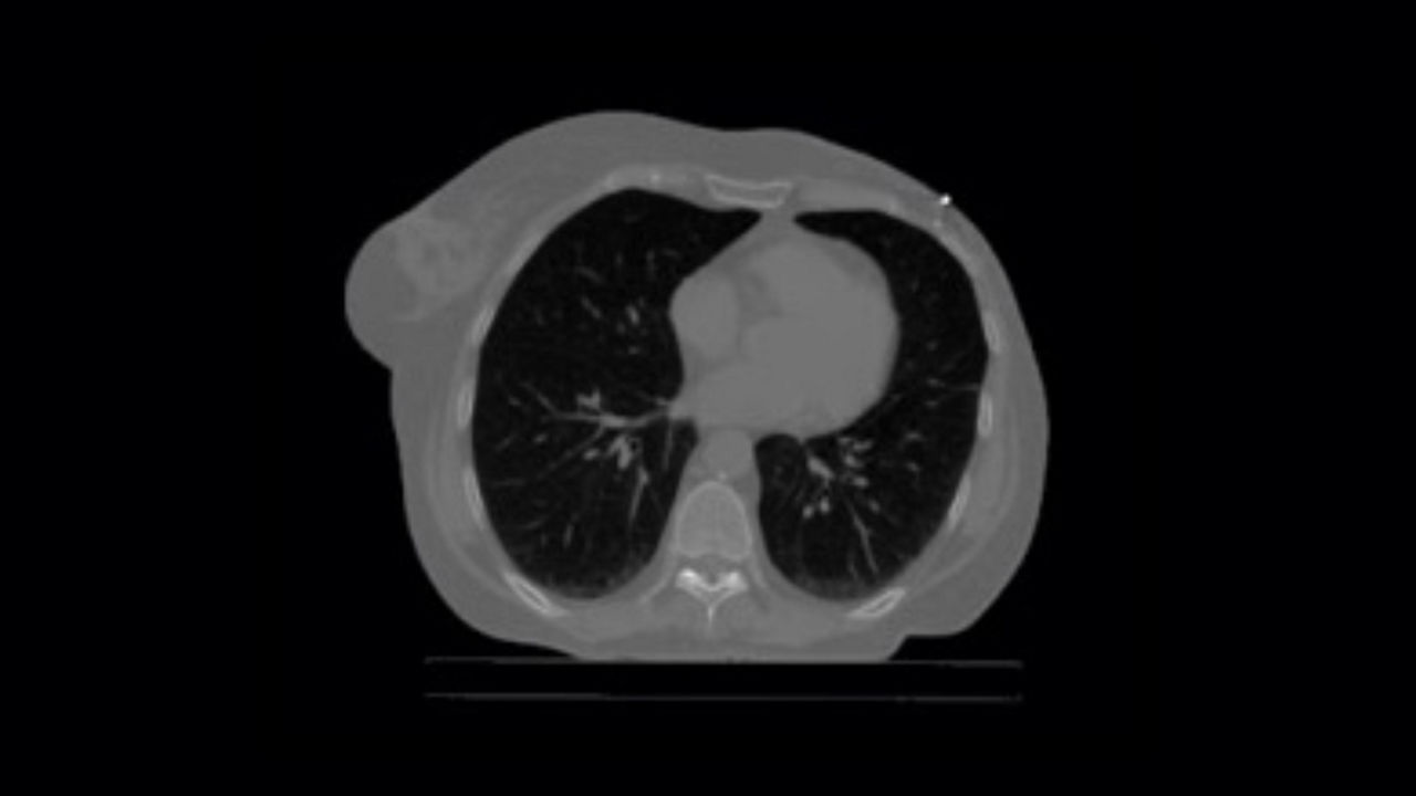 GEHEALTHCARE_CT_SmartSubscription_ProspectiveGating_1920x1080