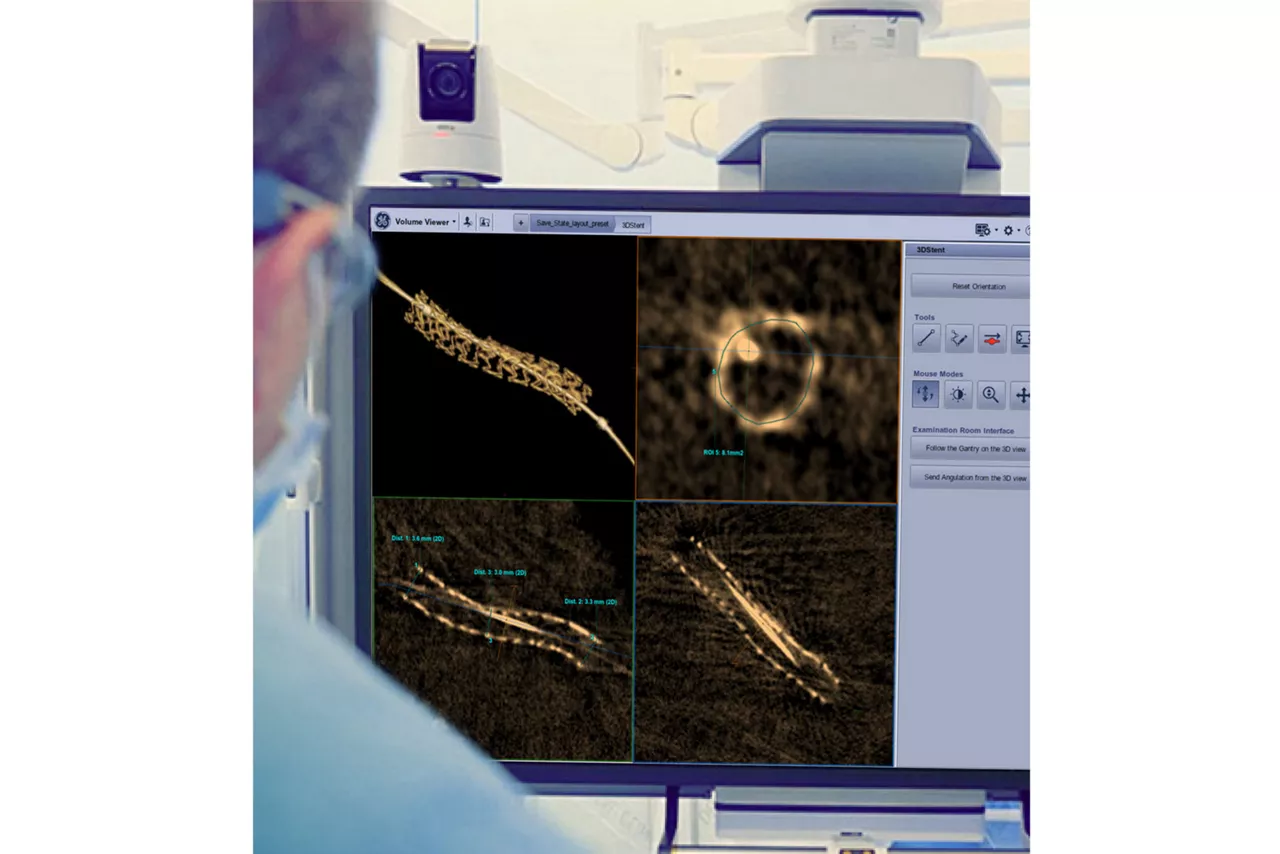 GEHeathCare_3DStent_Live_cathlab_pci