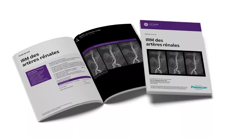 GEPixxoscan Case Studies MagazineDesktop 780x47601