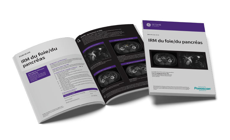GEPixxoscan Case Studies MagazineDesktop 780x47602