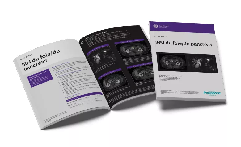 GEPixxoscan Case Studies MagazineDesktop 780x47602