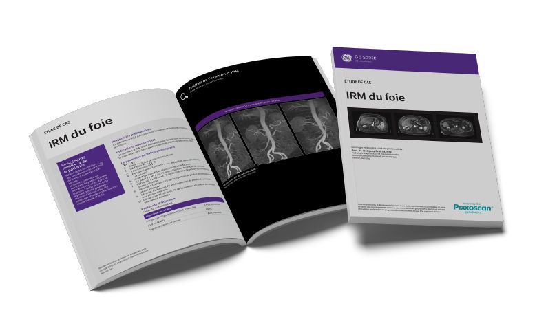 GEPixxoscan Case Studies MagazineDesktop 780x47603