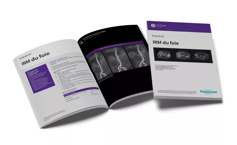 GEPixxoscan Case Studies MagazineDesktop 780x47603