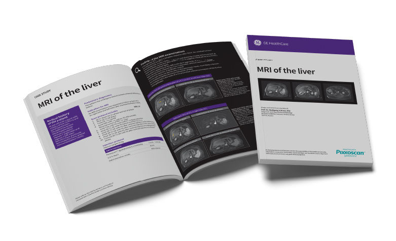 GEPixxoscan Case Studies MagazineDesktop 780x47604