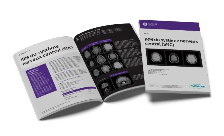 GEPixxoscan Case Studies MagazineDesktop 780x47604