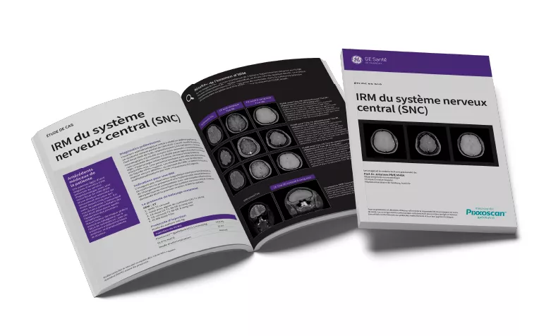 GEPixxoscan Case Studies MagazineDesktop 780x47604
