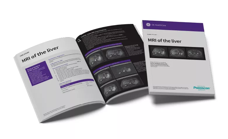 GEPixxoscan Case Studies MagazineDesktop 780x47604