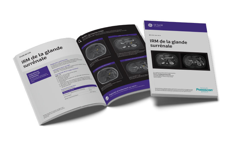 GEPixxoscan Case Studies MagazineDesktop 780x47605