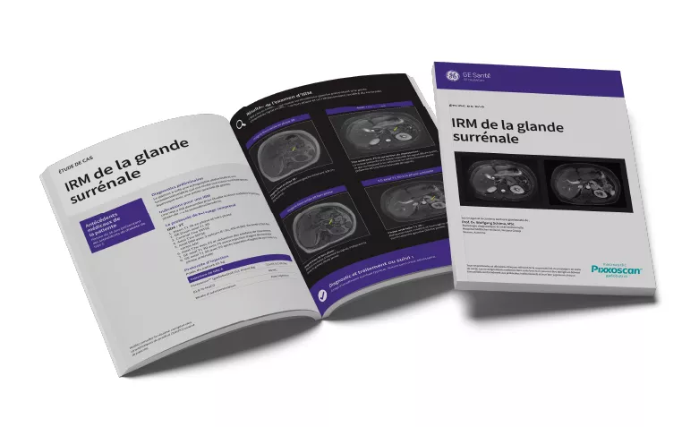 GEPixxoscan Case Studies MagazineDesktop 780x47605