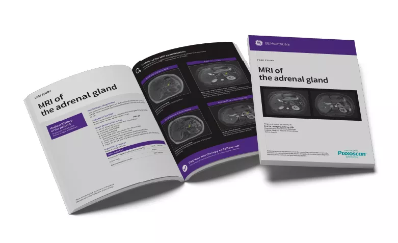 GEPixxoscan Case Studies MagazineDesktop 780x47605