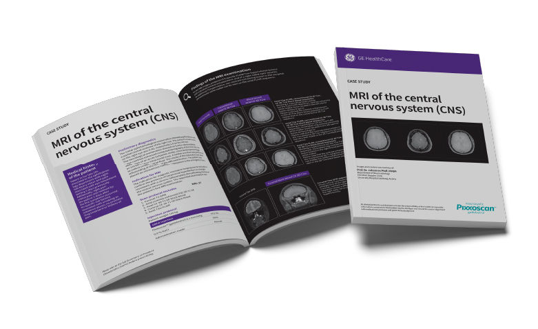 GEPixxoscan Case Studies MagazineDesktop 780x47606