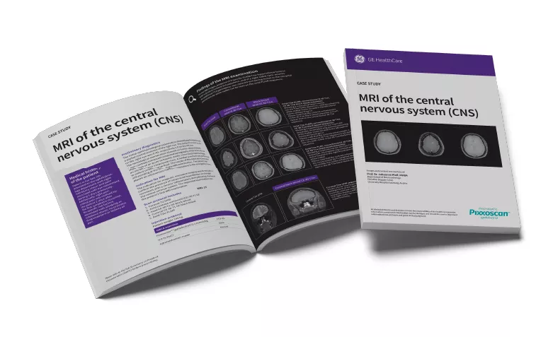 GEPixxoscan Case Studies MagazineDesktop 780x47606