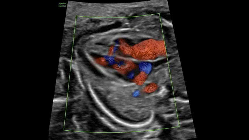 graphicflow-vsd-16w-image-tb-ci-en