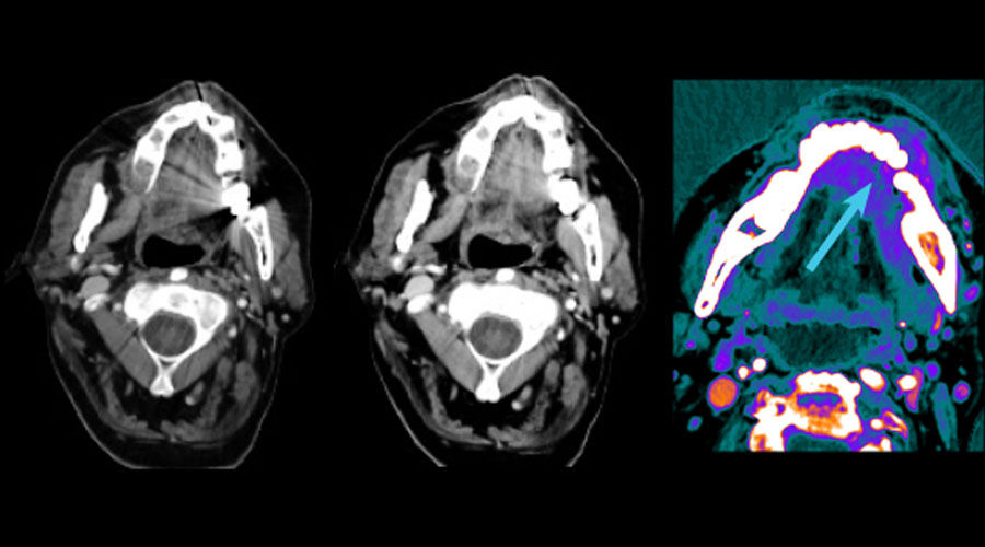 GSI-MAR-for-dual-energy-Full-Size