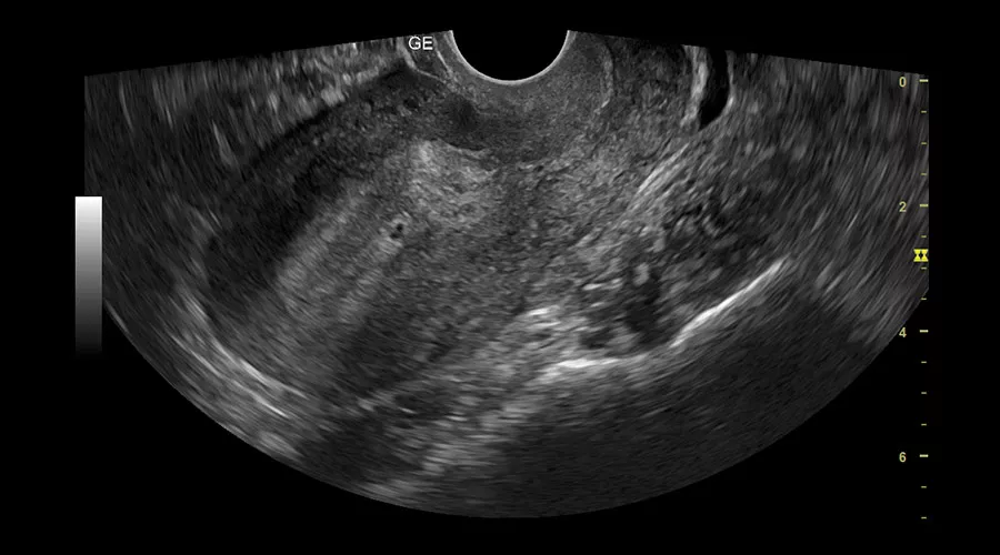 gynecological-imaging