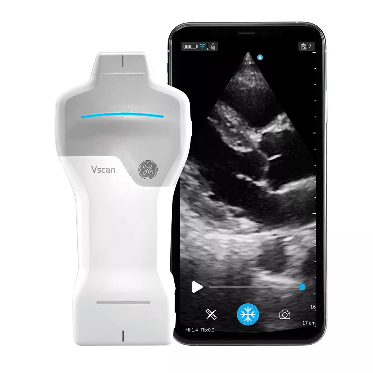 Ultrasonido portátil: Vscan Air™ SL