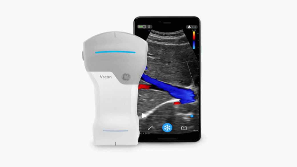 handheld-ultrasound-vscan-desktop