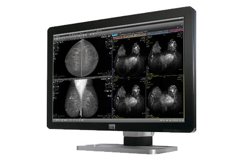 Breast Imaging