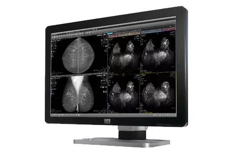 Breast Imaging