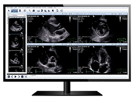 healthcare-it-centricity-universal-viewer-s-curve-CARD-capabilities