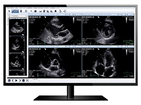 healthcare-it-centricity-universal-viewer-s-curve-CARD-capabilities