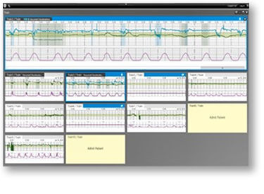 Centricity Perinatal Connect Central Surveillance