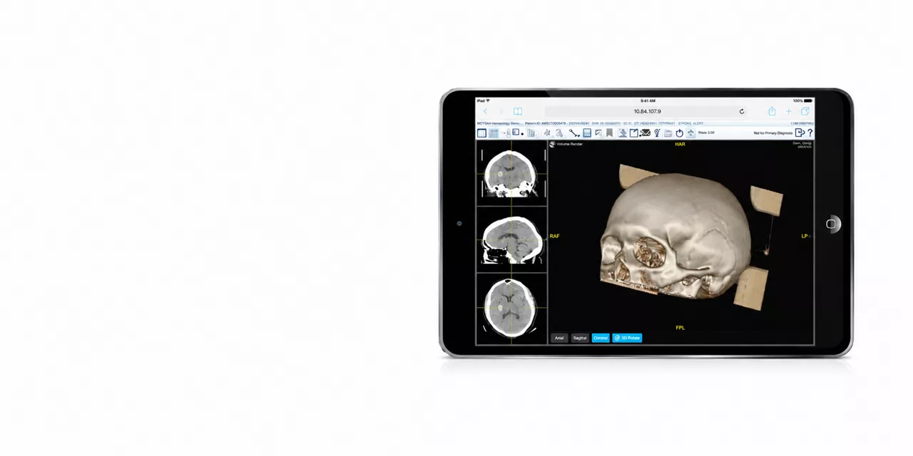 healthcare-it-ei-zfp-video-thumb-zfp-resized-2