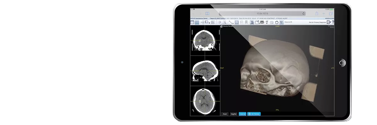 Centricity Universal Viewer Zero Footprint
