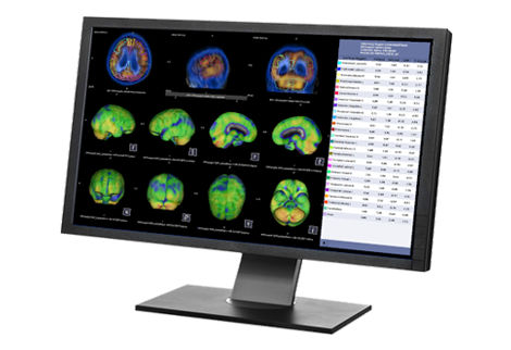healthcare-it-uv-s-curve-nuclear