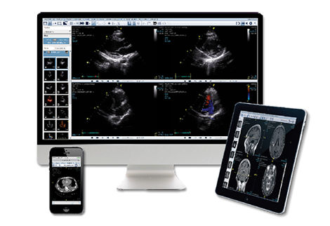 healthcare-it-uv-s-curve-zfp