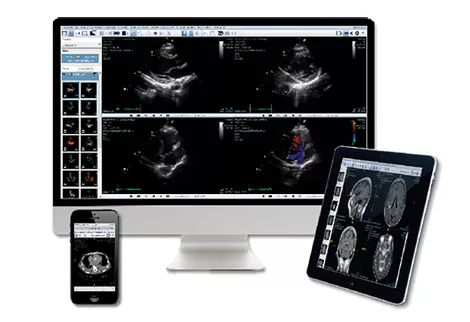 healthcare-it-uv-s-curve-zfp