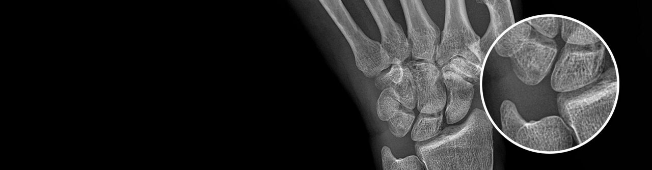 helix-advanced-image-processing-delivers