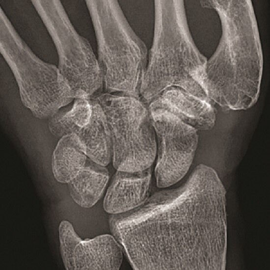 helix-advanced-image-product-tile-en