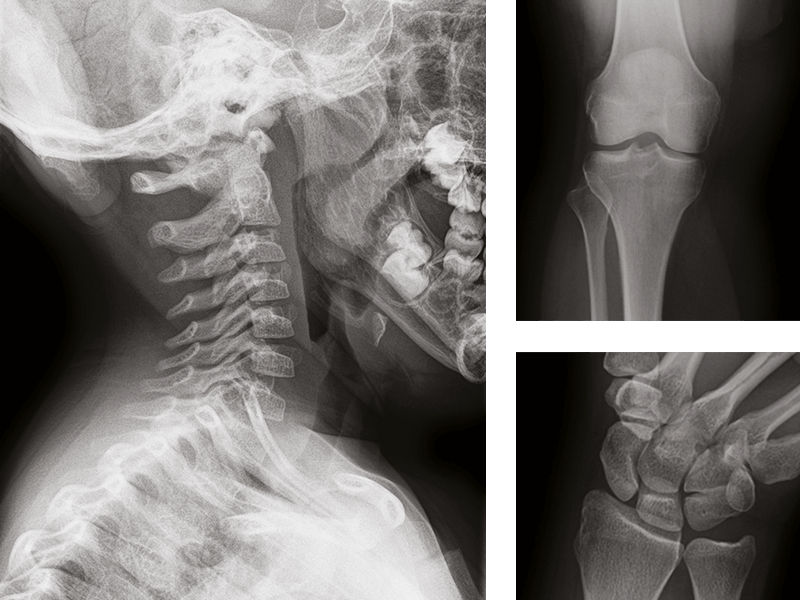 helix-anatomy-specific-image-2columns