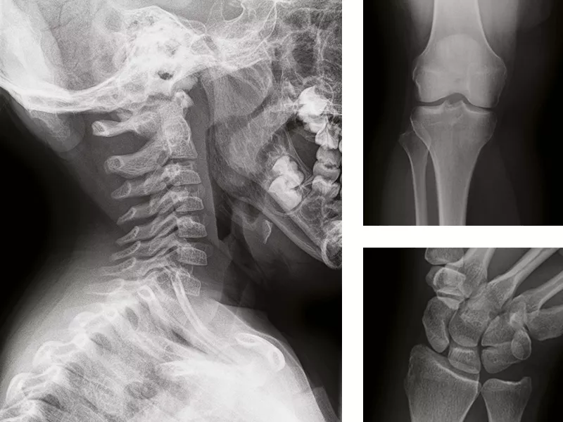 helix-anatomy-specific-image-2columns