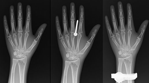 helix-feature-half-desktop