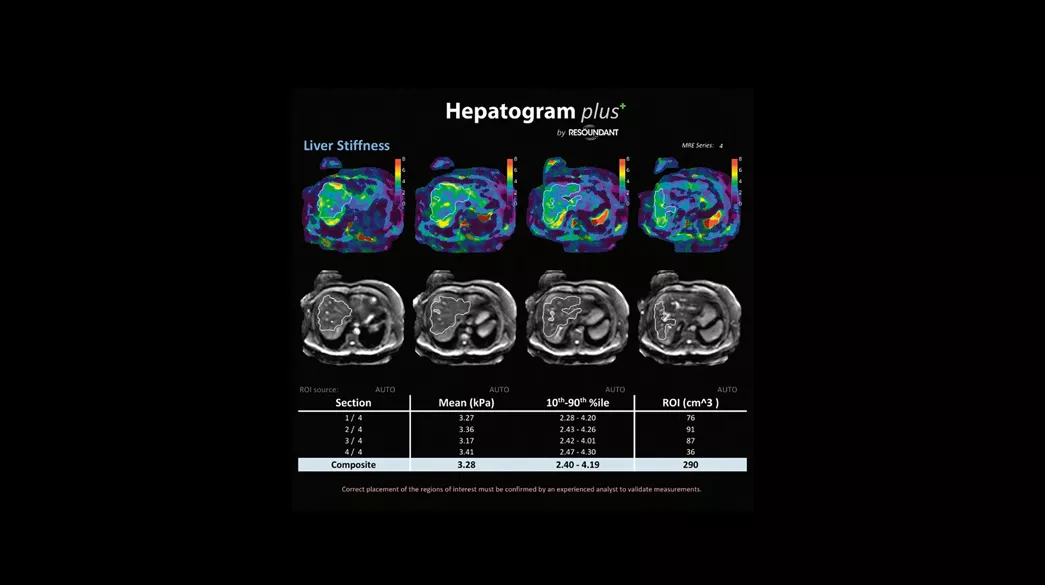 Hepatogramplus1040x585