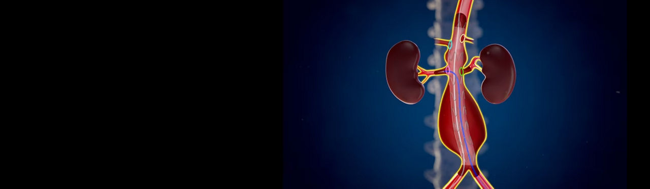 hero-evar-assist-desktop