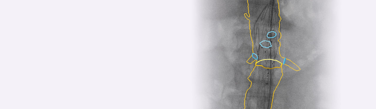 hero-evar-assist-desktop-v2-ba-en