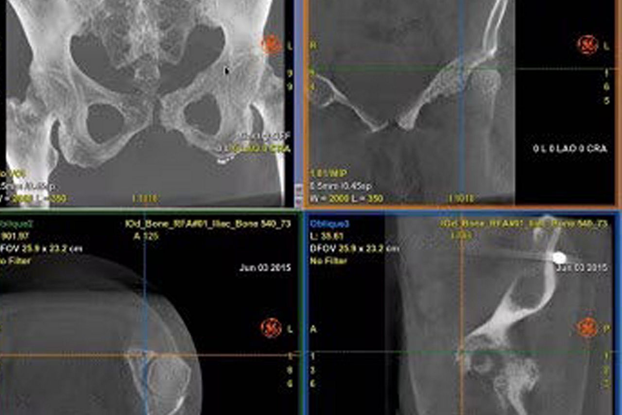 hero_sticky_scrolling_1-ci-en