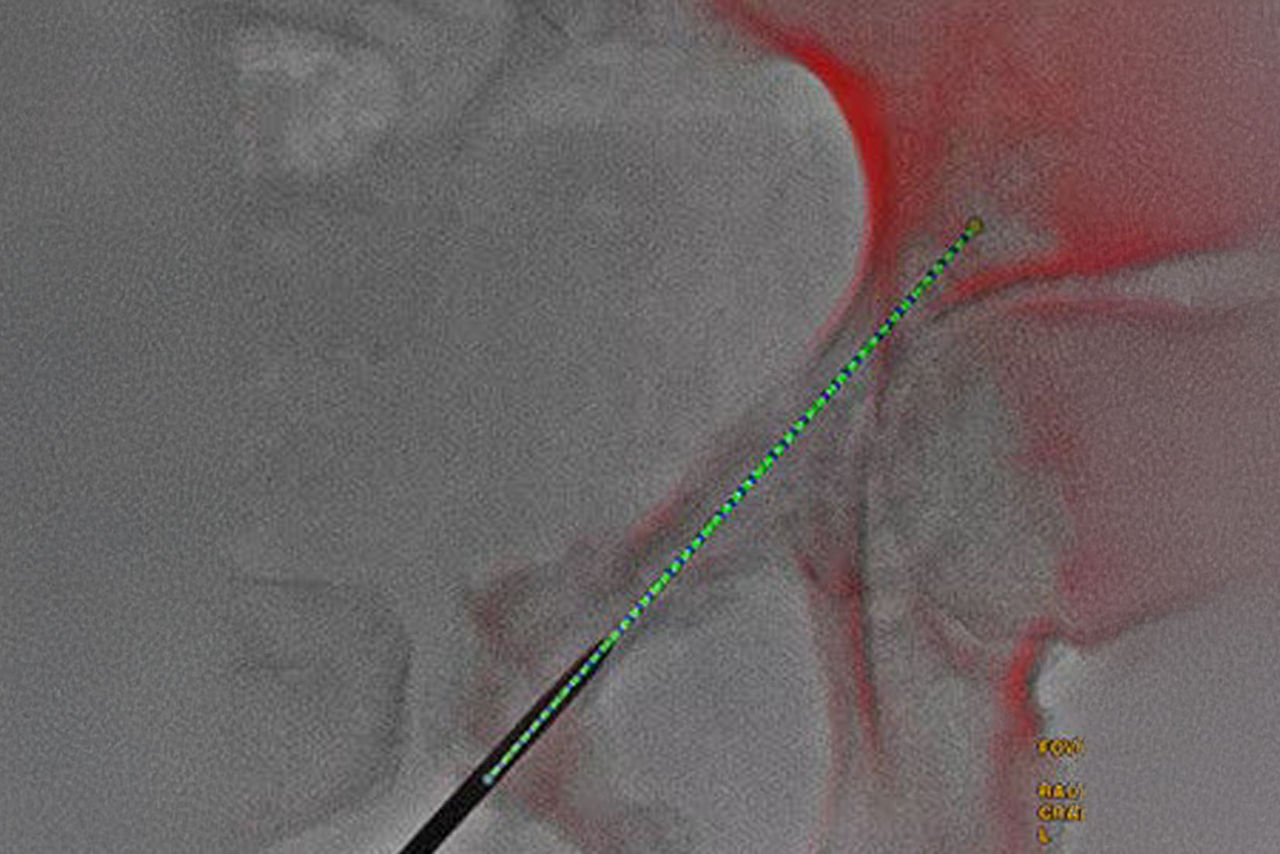 hero_sticky_scrolling_2-ci-en