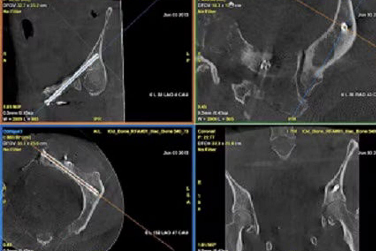 hero_sticky_scrolling_3-ci-en