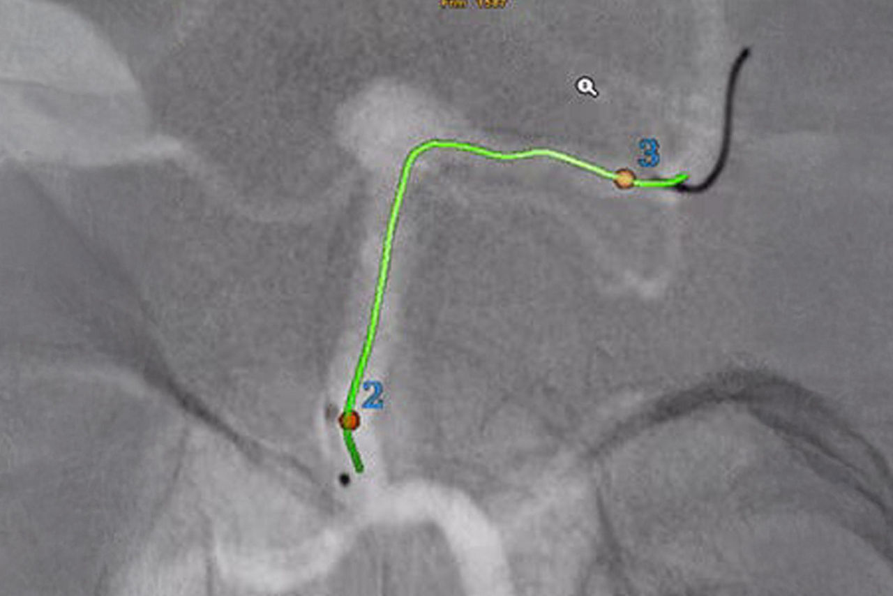 hero_sticky_scrolling_5-ci-en