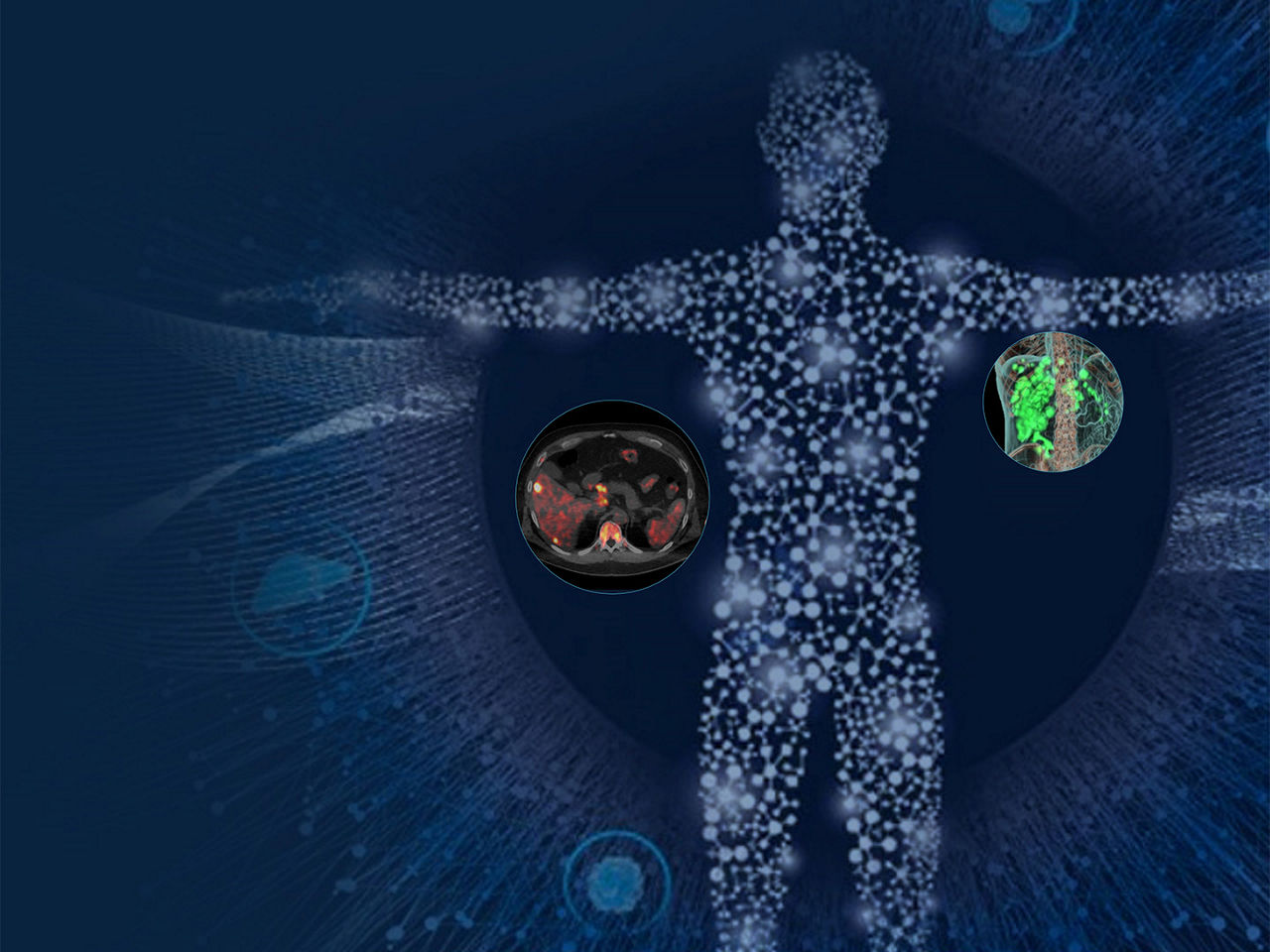 hope-with-theranostics-ArticleHero-ci-en