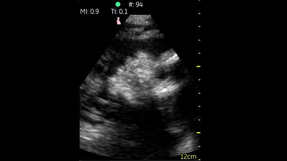 Obstetricia