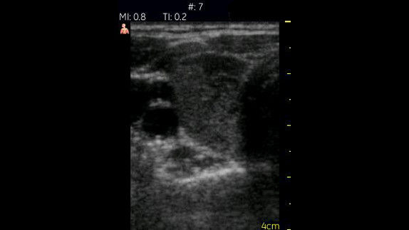 Soft Tissue