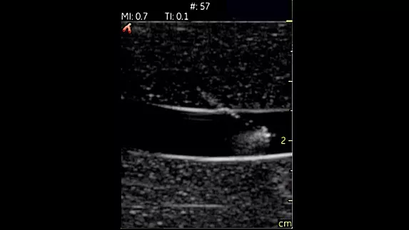 hotspot tours-vscan-vascular-procedure-guidance_jpg